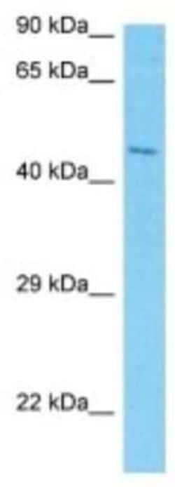 NO66 Rabbit anti-Human, Polyclonal, Novus Biologicals:Antibodies:Primary